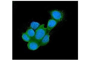 IF analysis of Galectin 3/LGALS3 using anti-Galectin 3/LGALS3 antibody (ABIN6719486). (Galectin 3 Antikörper  (AA 139-250))