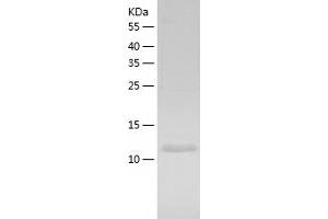 Western Blotting (WB) image for Proteasome (Prosome, Macropain) Assembly Chaperone 4 (PSMG4) (AA 1-123) protein (His tag) (ABIN7287492) (PSMG4 Protein (AA 1-123) (His tag))