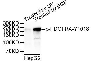 Western blot analysis of extracts of HepG2 cell line, using Phospho-PDGFRA-Y1018 antibody. (PDGFRA Antikörper  (pTyr1018))