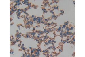 Used in DAB staining on fromalin fixed paraffin- embedded Kidney tissue (TNFRSF19 Antikörper  (AA 61-163))