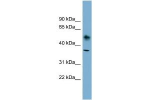 WB Suggested Anti-ATP1B1 Antibody Titration:  0. (ATP1B1 Antikörper  (N-Term))