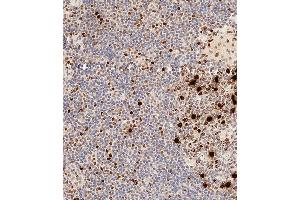 Immunohistochemical analysis of paraffin-embedded Human tonsil tissue using A performed on the Leica® BOND RXm. (HIST1H3B3 (pSer10) Antikörper)