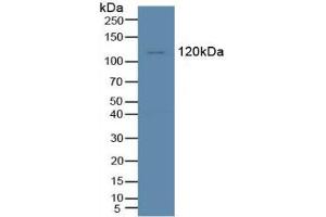 Western blot analysis of Human K562 Cells. (TIE1 Antikörper  (AA 435-609))