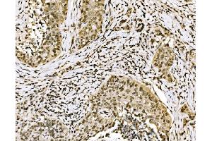 IHC analysis of SPHK1 using anti-SPHK1 antibody (ABIN7600168). (SPHK1 Antikörper  (AA 16-267))