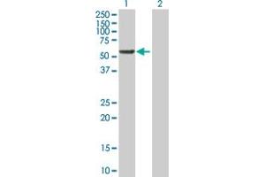 Western Blot analysis of RGS6 expression in transfected 293T cell line by RGS6 MaxPab polyclonal antibody. (RGS6 Antikörper  (AA 1-472))