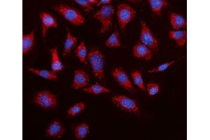 IF analysis of Elovl4 using anti-Elovl4 antibody (ABIN7599257). (ELOVL4 Antikörper  (AA 1-312))