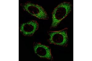 Fluorescent ige of  cell stained with P2K2 Antibody  (ABIN6243254 and ABIN6579024)/SA080220AJ. (MEK2 Antikörper  (AA 372-400))