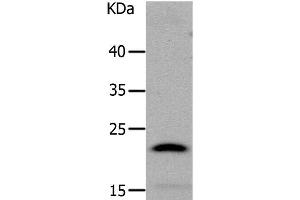 Western Blot analysis of Human liver cancer tissue using LCN2 Polyclonal Antibody at dilution of 1:1050 (Lipocalin 2 Antikörper)