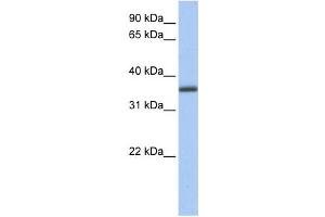 Western Blotting (WB) image for anti-UDP-Galactose-4-Epimerase (GALE) antibody (ABIN2459745) (GALE Antikörper)