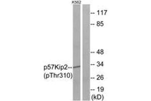 Western Blotting (WB) image for anti-Cyclin-Dependent Kinase Inhibitor 1C (p57, Kip2) (CDKN1C) (AA 267-316), (pThr310) antibody (ABIN1531619)