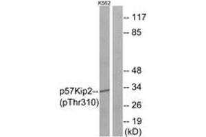 Western blot analysis of extracts from K562 cells treated with insulin 0. (CDKN1C Antikörper  (pThr310))