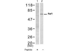 Image no. 1 for anti-V-Raf-1 Murine Leukemia Viral Oncogene Homolog 1 (RAF1) (Ser338) antibody (ABIN319325) (RAF1 Antikörper  (Ser338))