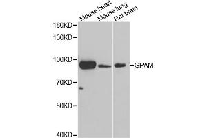 Western blot analysis of extracts of various cell lines, using GPAM antibody (ABIN5973973) at 1/1000 dilution. (GPAM Antikörper)