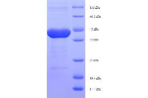 SDS-PAGE (SDS) image for Protease, serine, 1 (Trypsin 1) (PRSS1) (AA 24-246) protein (His-SUMO Tag) (ABIN5710159) (PRSS1 Protein (AA 24-246) (His-SUMO Tag))