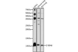 Western blot analysis of extracts of various cell lines, using S100 antibody (ABIN1682611, ABIN3018540, ABIN3018541 and ABIN5664641) at 1:1000 dilution.