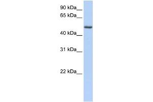 WB Suggested Anti-PHLDA1 Antibody Titration: 0. (PHLDA1 Antikörper  (C-Term))