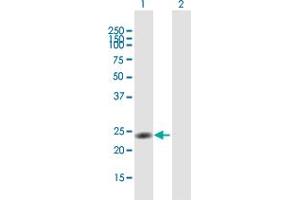 Western Blotting (WB) image for anti-Nuclear Receptor Subfamily 0, Group B, Member 2 (NR0B2) (AA 1-257) antibody (ABIN521892)