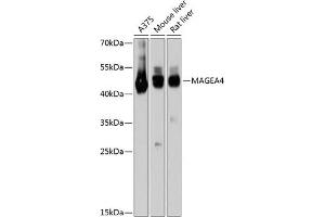 Western blot analysis of extracts of various cell lines, using M antibody (ABIN6128211, ABIN6143437, ABIN6143438 and ABIN6215295) at 1:3000 dilution. (MAGEA4 Antikörper  (AA 28-317))