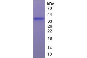SDS-PAGE of Protein Standard from the Kit (Highly purified E. (ARG ELISA Kit)