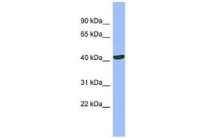 SERPINB13 antibody used at 1 ug/ml to detect target protein.