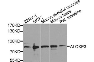 Western blot analysis of extracts of various cell lines, using ALOXE3 antibody (ABIN5974533) at 1/1000 dilution. (ALOXE3 Antikörper)