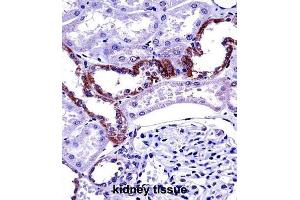 Immunohistochemistry (IHC) image for anti-Mucolipin 1 (MCOLN1) antibody (ABIN2997394)