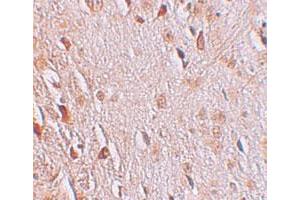 Immunohistochemical staining of human brain cells with WIZ polyclonal antibody  at 2. (WIZ Antikörper  (C-Term))
