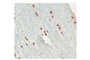 A/ [IHC-PZ] (optimal processing) human optic nerve (short post mortem interval) fixed by immersion in zinc-based fixative (BD Pharmingen 552658), processed to minimize antigen loss (shortened protocol, reduced exposure to high temperature); embedded in paraffin wax; sectioned at 3 microns  A2/ [IHC-PZ + FF] As above for initial fixation then post-fixed in 10% buffered formalin for 5 days  B/ [IHC-P] human optic nerve and spinal cord fixed in 10% buffered formalin (relatively short post mortem interval and fixation duration); standard processing; embedded in paraffin wax; sectioned at 3 microns  Controls Negative: omission of primary. (SOX10 Antikörper  (Middle Region))