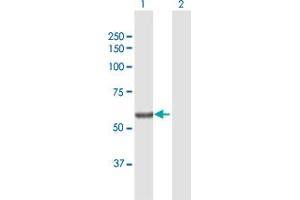 Western Blot analysis of SGPL1 expression in transfected 293T cell line by SGPL1 MaxPab polyclonal antibody. (SGPL1 Antikörper  (AA 1-568))