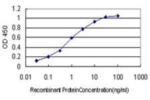 Detection limit for recombinant GST tagged QPRT is approximately 0. (QPRT Antikörper  (AA 198-297))