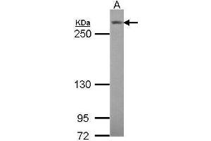 WB Image Sample (30 ug of whole cell lysate) A: Hela 5% SDS PAGE antibody diluted at 1:1000 (NOTCH3 Antikörper  (C-Term))