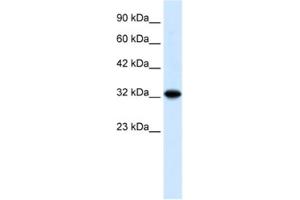 Western Blotting (WB) image for anti-Zinc Finger and BTB Domain Containing 32 (ZBTB32) antibody (ABIN2460305) (ZBTB32 Antikörper)