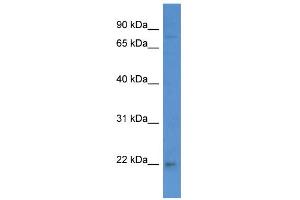 WB Suggested Anti-WIBG Antibody Titration: 0. (PYM Antikörper  (C-Term))