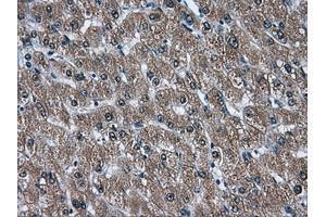 Immunohistochemical staining of paraffin-embedded liver tissue using anti-AKR1A1mouse monoclonal antibody. (AKR1A1 Antikörper)
