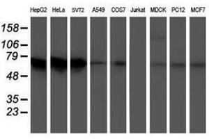 Image no. 2 for anti-5-Aminoimidazole-4-Carboxamide Ribonucleotide Formyltransferase/IMP Cyclohydrolase (ATIC) antibody (ABIN1496503) (ATIC Antikörper)