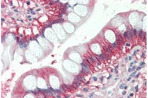 Human Small Intestine (formalin-fixed, paraffin-embedded) stained with x antibody ABIN337227 at 2. (GTPase NRas Antikörper  (AA 167-179))