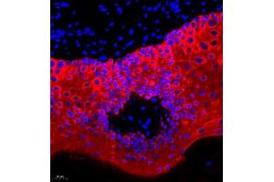 Immunofluorescence (Paraffin-embedded Sections) (IF (p)) image for anti-Keratin 13 (KRT13) (N-Term) antibody (ABIN7074412)