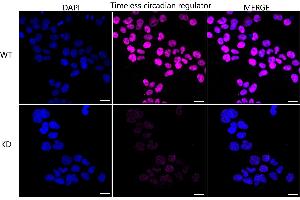anti-Timeless Homolog (TIMELESS) antibody