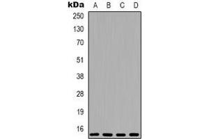 Western blot analysis of 4EBP1 expression in MCF7 (A), HEK293T (B), mouse brain (C), rat brain (D) whole cell lysates. (eIF4EBP1 Antikörper  (N-Term))