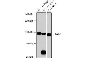 Western blot analysis of extracts of various cell lines, using KB antibody (ABIN1680550, ABIN3015032, ABIN3015033, ABIN5663568 and ABIN6213605) at 1:1000 dilution. (KAT2B Antikörper  (AA 583-832))