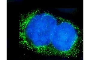 IF analysis of Alkaline phosphatase/ALPL using anti-Alkaline phosphatase/ALPL antibody (ABIN7603162).