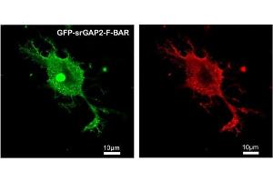 Immunofluorescence (IF) image for anti-SLIT-ROBO rho GTPase Activating Protein 2 (SRGAP2) antibody (ABIN5935194) (SRGAP2 Antikörper)