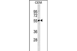 IGHD Antibody (N-term)(Ascites) ABIN1539994 western blot analysis in CEM cell line lysates (35 μg/lane). (IgD Antikörper  (N-Term))