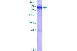 CAMK2D Protein (AA 1-478) (GST tag)