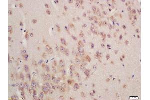 Formalin-fixed and paraffin embedded mouse brain labeled with Rabbit Anti-GSTA3 Polyclonal Antibody, Unconjugated (ABIN755767) at 1:200 followed by conjugation to the secondary antibody and DAB staining