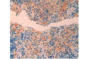 IHC-P analysis of Rat Spleen Tissue, with DAB staining. (CRH Antikörper  (AA 39-187))