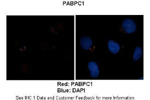 Sample Type :  Human brain stem cells (NT2)   Primary Antibody Dilution :   1:500  Secondary Antibody :  Goat anti-rabbit Alexa Fluor 594  Secondary Antibody Dilution :   1:1000  Color/Signal Descriptions :  Red: PABPC1 Blue: DAPI  Gene Name :  PABPC1  Submitted by :  Dr. (PABP Antikörper  (Middle Region))