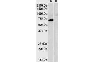 Western Blotting (WB) image for Monoamine Oxidase A (MAOA) peptide (ABIN368822) (Monoamine Oxidase A (MAOA) Peptid)