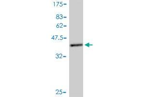 Western Blot detection against Immunogen (41. (TRAPPC2 Antikörper  (AA 1-140))