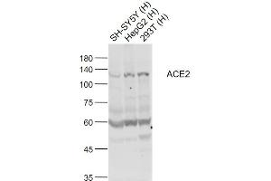 Lane 1: SH-SY5Y cell lysates; Lane 2: HepG2 cell lysates; Lane 3: 293T cell lysates probed with ACE2 Polyclonal Antibody, Unconjugated (bs-23443R) at 1:1000 dilution and 4˚C overnight incubation. (ACE2 Antikörper  (AA 451-550))